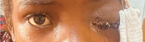 Details are in the caption following the image