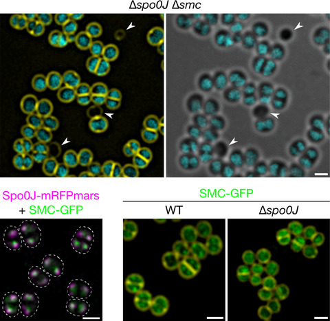Spo0J and SMC are required for normal chromosome segregation in Staphylococcus aureus