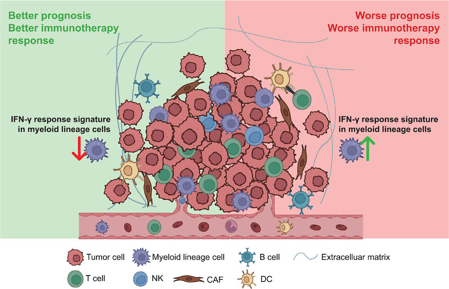 A myeloid IFN gamma response gene signature correlates with cancer prognosis