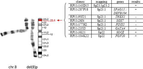 Is interstitial 8p23 microdeletion responsible of 46,XY gonadal dysgenesis? One case report from birth to puberty