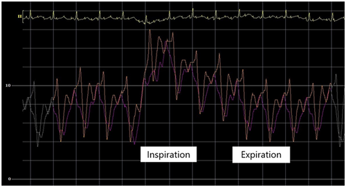 Details are in the caption following the image Details are in the caption following the image