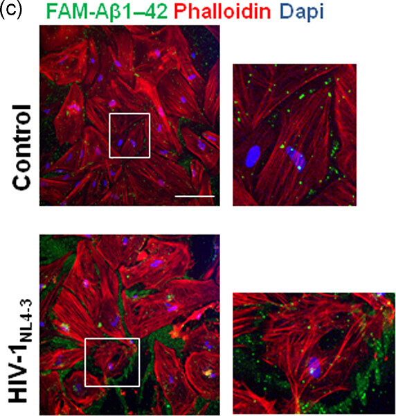HIV-1 increases extracellular amyloid-beta levels through neprilysin regulation in primary cultures of human astrocytes