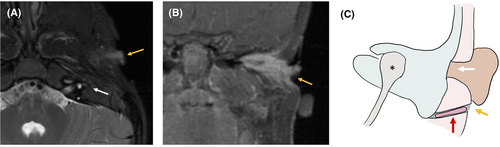 Details are in the caption following the image