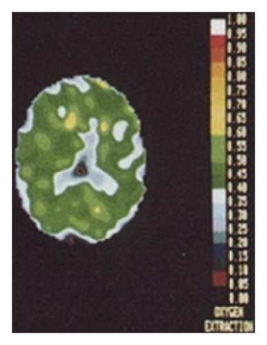 Details are in the caption following the image