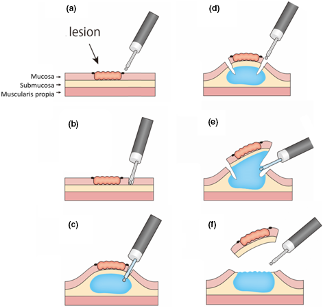 Details are in the caption following the image