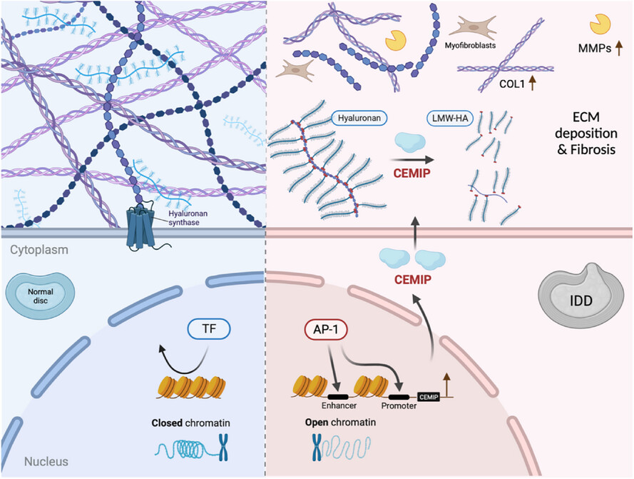 Upregulated CEMIP promotes intervertebral disc degeneration via AP-1-mediated change in chromatin accessibility