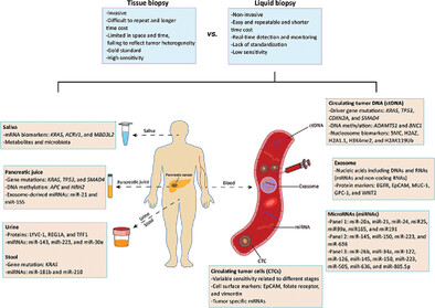 Early screening and diagnosis strategies of pancreatic cancer: a comprehensive review
