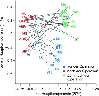 “Targeted Metabolomics” in der Biomarkerforschung