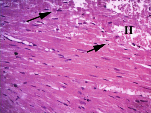 Details are in the caption following the image