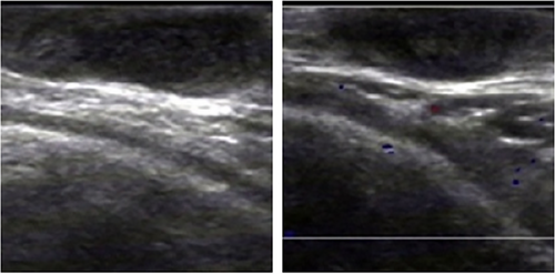 Details are in the caption following the image
