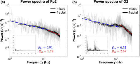 Separating scale-free and oscillatory components of neural activity in schizophrenia