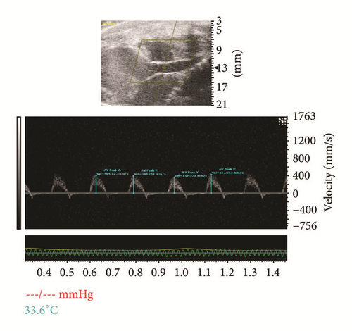 Details are in the caption following the image Details are in the caption following the image