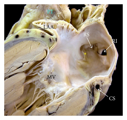 Details are in the caption following the image
