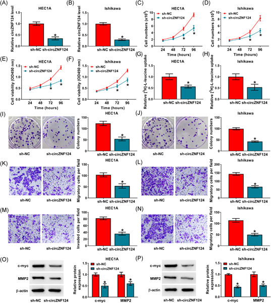 CircZNF124 regulates cell proliferation, leucine uptake, migration and invasion by miR-199b-5p/SLC7A5 pathway in endometrial cancer