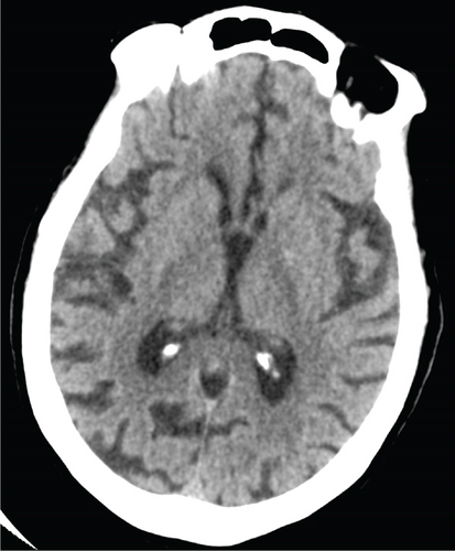 Details are in the caption following the image