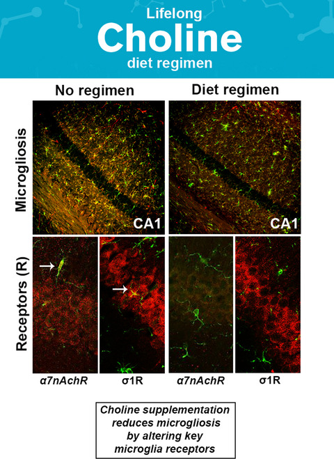 Lifelong choline supplementation ameliorates Alzheimer’s disease pathology and associated cognitive deficits by attenuating microglia activation