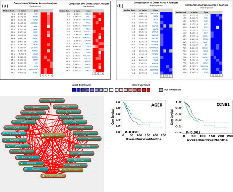 Identification of genes associated with cancer progression and prognosis in lung adenocarcinoma: Analyses based on microarray from Oncomine and The Cancer Genome Atlas databases