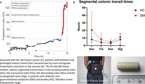 Colonic motility in patients with type 1 diabetes and gastrointestinal symptoms