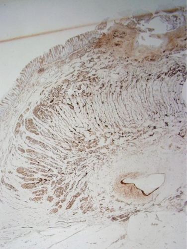 Details are in the caption following the image