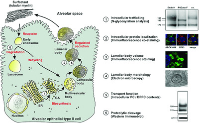 ABCA3 missense mutations causing surfactant dysfunction disorders have distinct cellular phenotypes