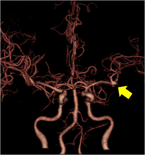 Details are in the caption following the image Details are in the caption following the image