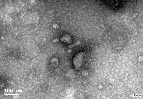 Details are in the caption following the image