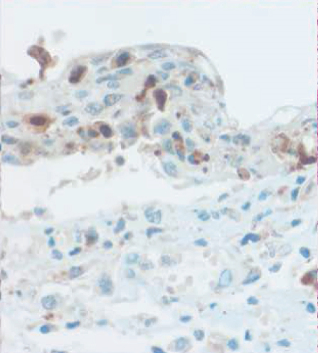 Details are in the caption following the image