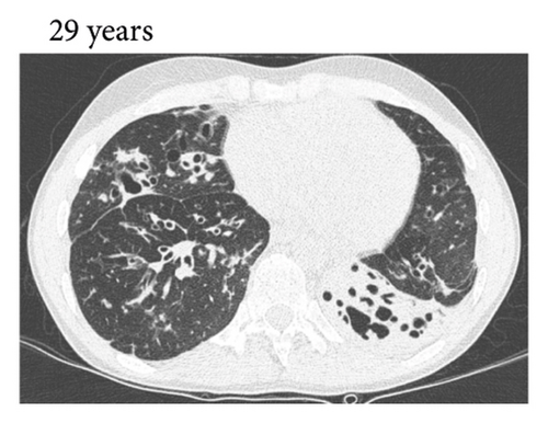 Details are in the caption following the image