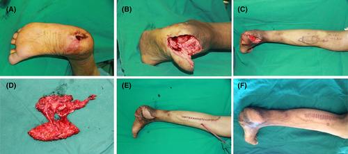 Details are in the caption following the image Details are in the caption following the image