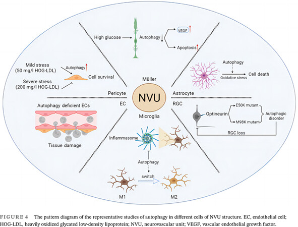 Autophagy in the retinal neurovascular unit: New perspectives into diabetic retinopathy 视网膜神经血管单元自噬:糖尿病视网膜病变的新视角