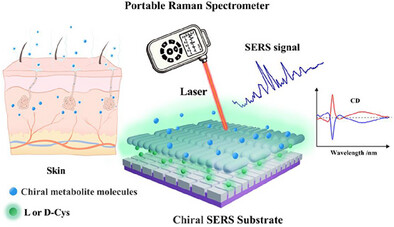 Wearable SERS-Microfluidic Patch for Real-Time in Situ Monitoring of Chiral Metabolites in Sweat