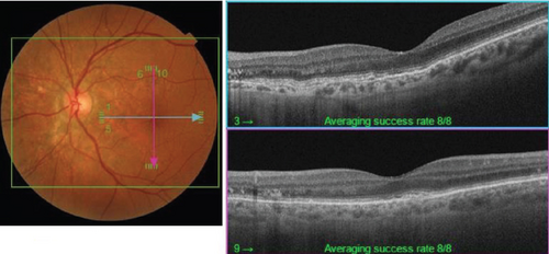 Details are in the caption following the image Details are in the caption following the image