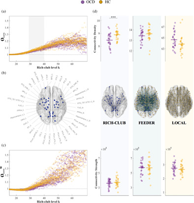 Abnormal white-matter rich-club organization in obsessive–compulsive disorder