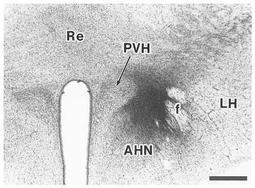 Details are in the caption following the image