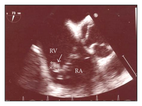 Details are in the caption following the image Details are in the caption following the image