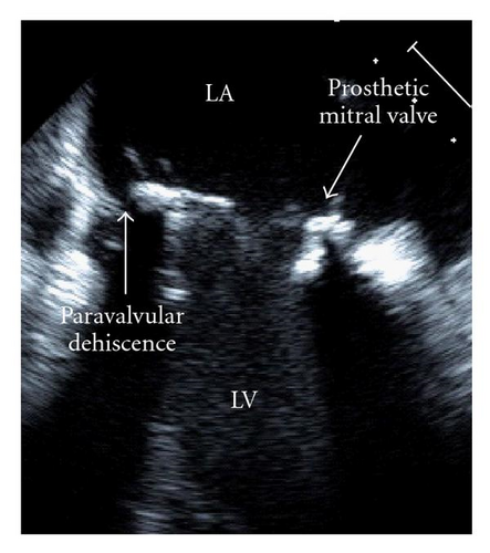 Details are in the caption following the image