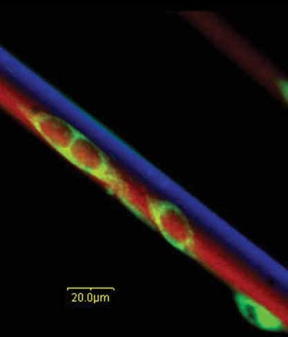 Micropatterned Fiber Scaffolds for Spatially Controlled Cell Adhesion