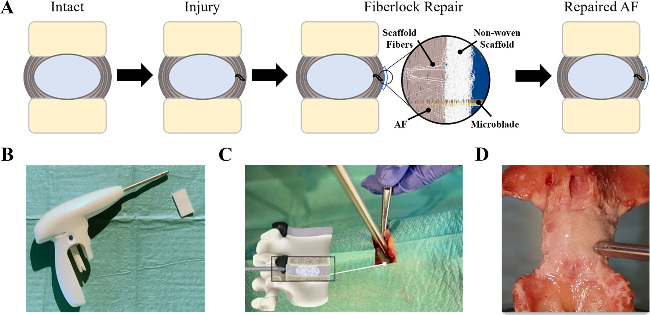 Annulus Fibrosus Repair via Interpenetration of a Non-Woven Scaffold Supports Tissue Integration and Prevents Re-Herniation