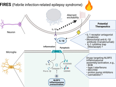 Hypothesis: Febrile infection-related epilepsy syndrome is a microglial NLRP3 inflammasome/IL-1 axis-driven autoinflammatory syndrome