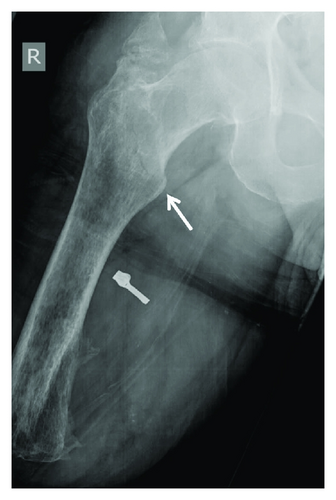Details are in the caption following the image