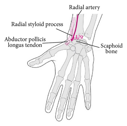Details are in the caption following the image