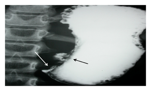 Details are in the caption following the image
