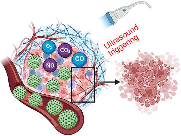 Precision gas therapy by ultrasound-triggered for anticancer therapeutics