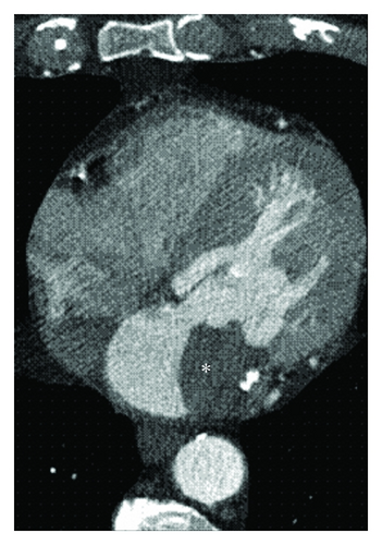 Details are in the caption following the image
