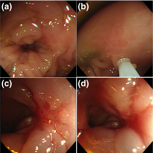 Details are in the caption following the image Details are in the caption following the image