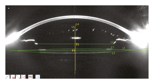 Details are in the caption following the image Details are in the caption following the image