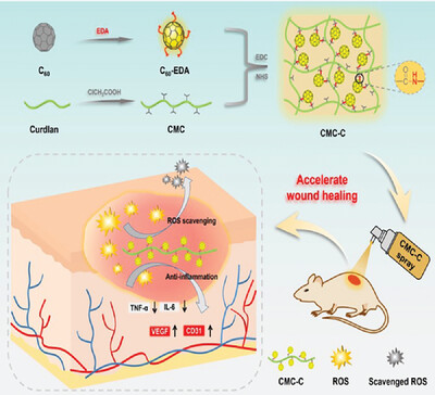 Novel Sprayable Antioxidative Dressing Based on Fullerene and Curdlan for Accelerating Chronic Wound Healing