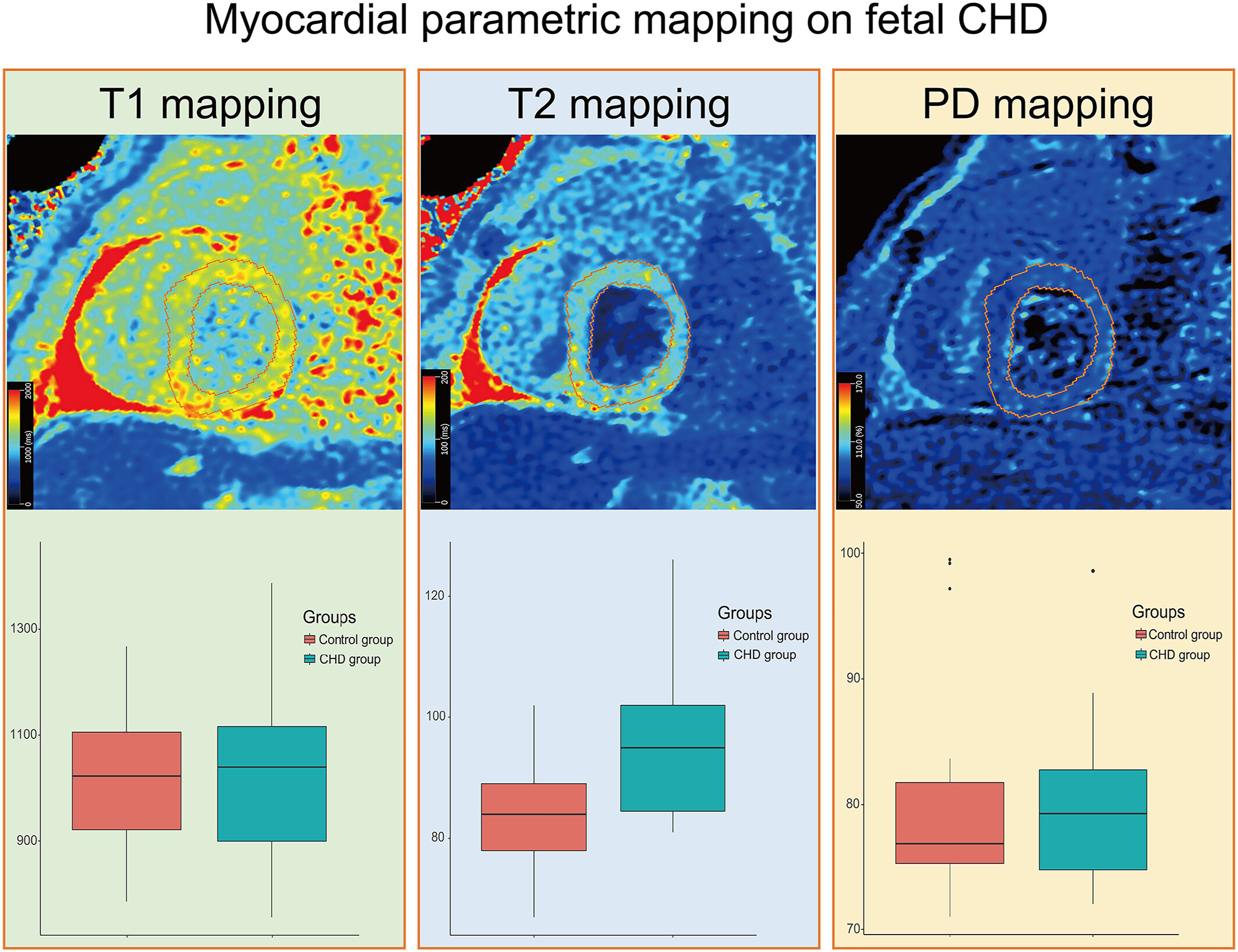 Association Between Fetal Myocardial Alterations and Congenital Heart Disease Based on Post-Mortem Myocardial MRI