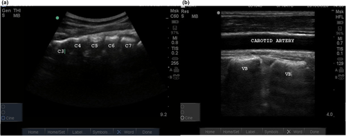 Details are in the caption following the image Details are in the caption following the image