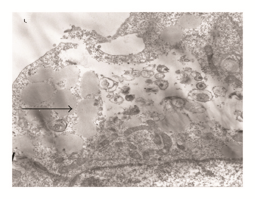 Details are in the caption following the image